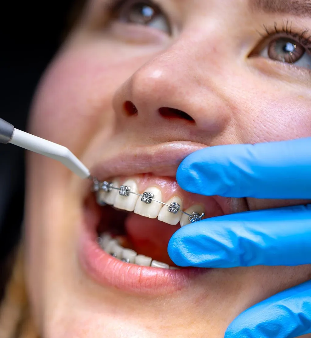 Adult Orthodontics