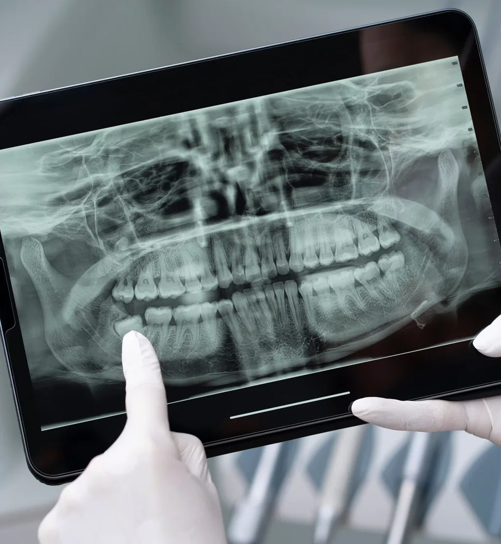 Digital X-rays & Diagnostics