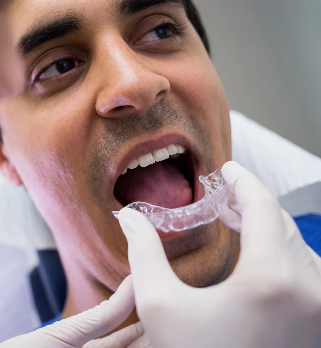 Mouthguards & Nightguards