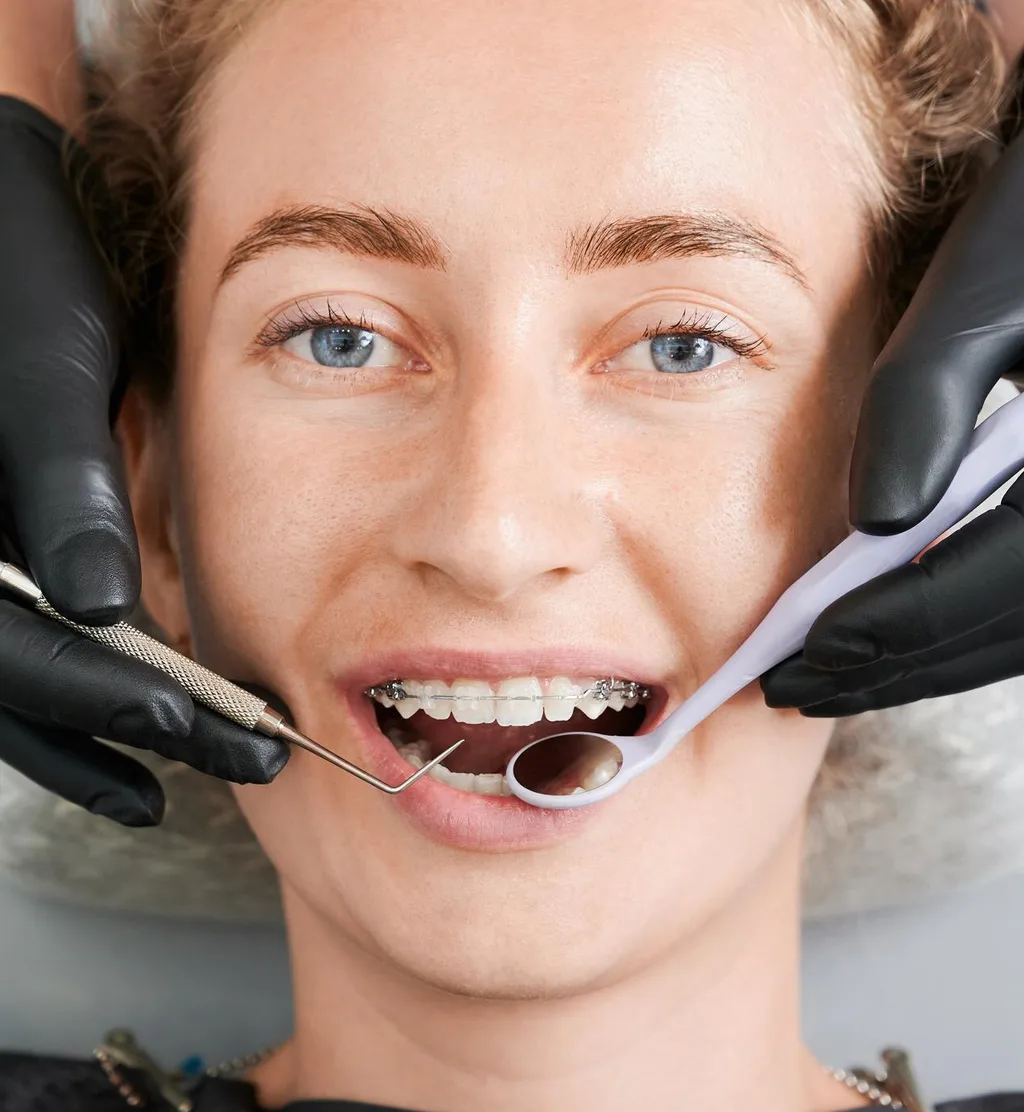 Orthodontic Retreatment