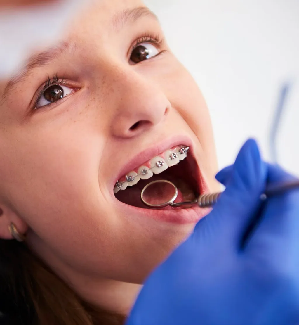 Orthodontics for Children